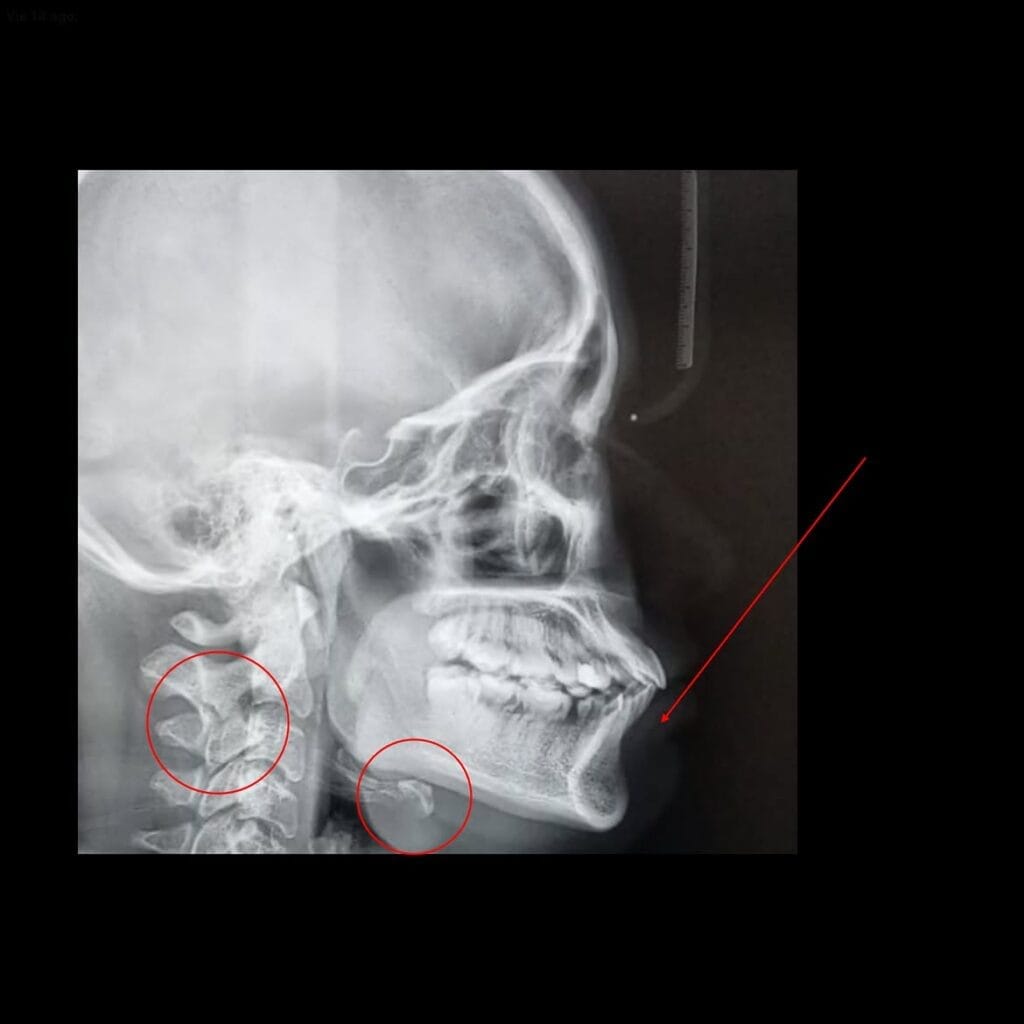Radiografía y estudio de ortodoncia utilizados para planificar un tratamiento.